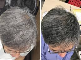 物理增髮新客專屬折扣